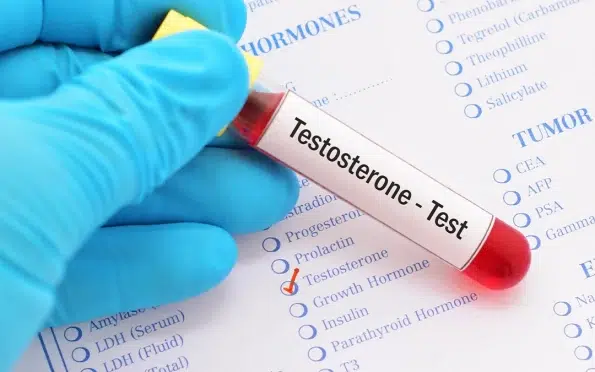 Testosterone